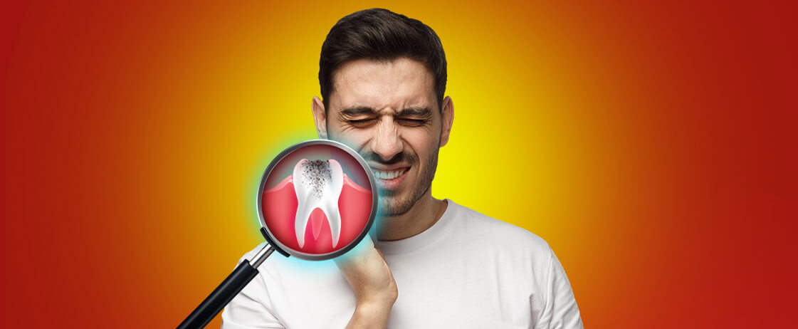 Clove: Perfect Remedy for Dental Troubles